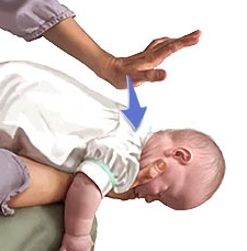 Foreign Body Ingestion in newborn