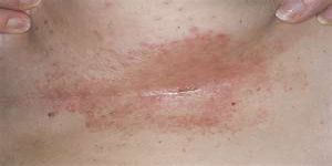 Παράτριμμα