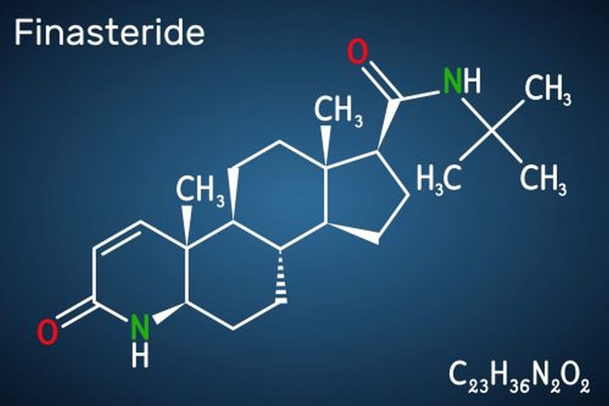 Φιναστερίδη