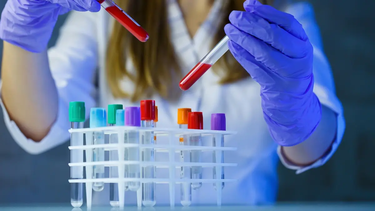 Βιοχημικές εξετάσεις