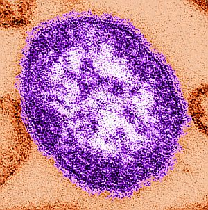 Ο ιός της ιλαράς