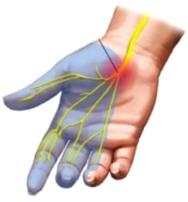 Περιοχή κατανομής των αισθητικών κλάδων του μέσου νεύρου