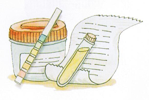 Έλεγχος μικρολευκωματινουρίας στα ούρα