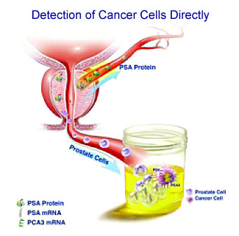 Άμεση ανίχνευση των καρκινικών κυττάρων